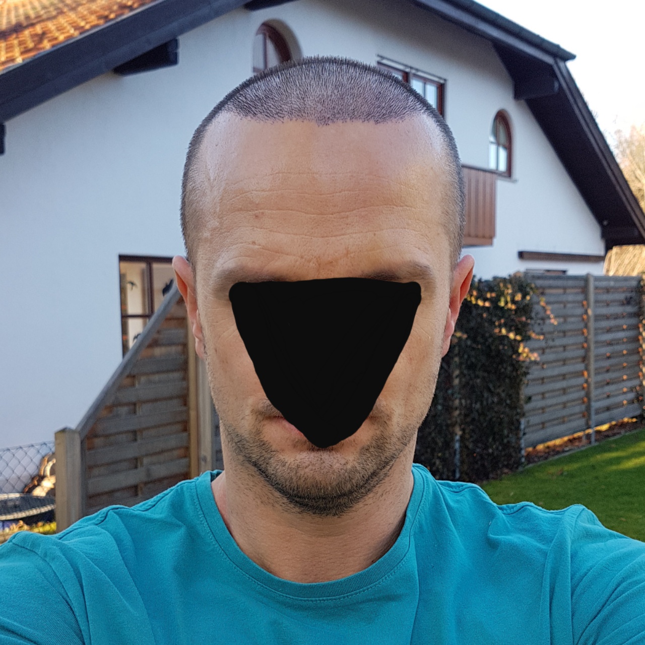 /foren/transplant/index.php?t=getfile&id=44978&private=0