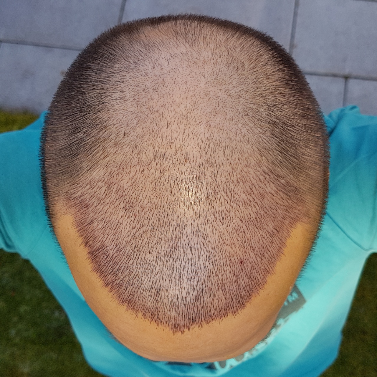 /foren/transplant/index.php?t=getfile&id=44979&private=0