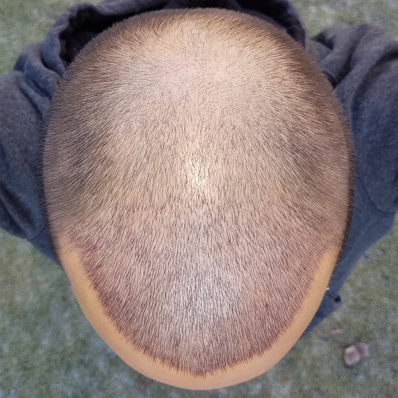 /foren/transplant/index.php?t=getfile&id=44983&private=0