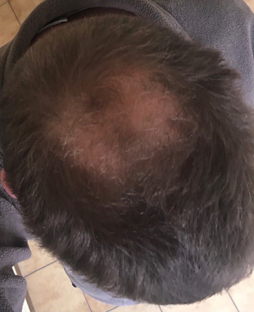 /foren/transplant/index.php?t=getfile&id=45049&private=0