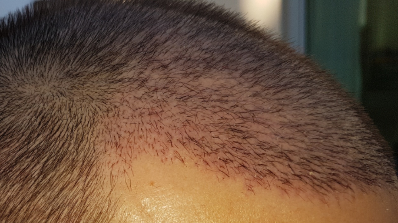 /foren/transplant/index.php?t=getfile&id=45079&private=0