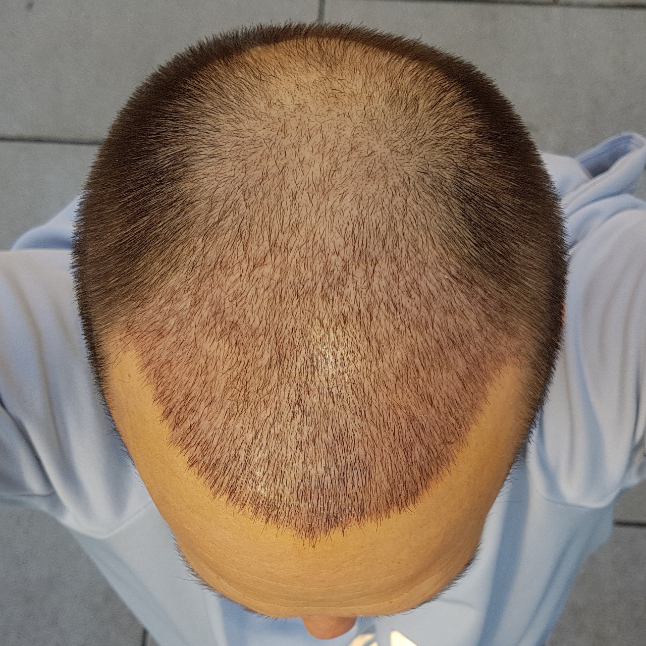 /foren/transplant/index.php?t=getfile&id=45080&private=0