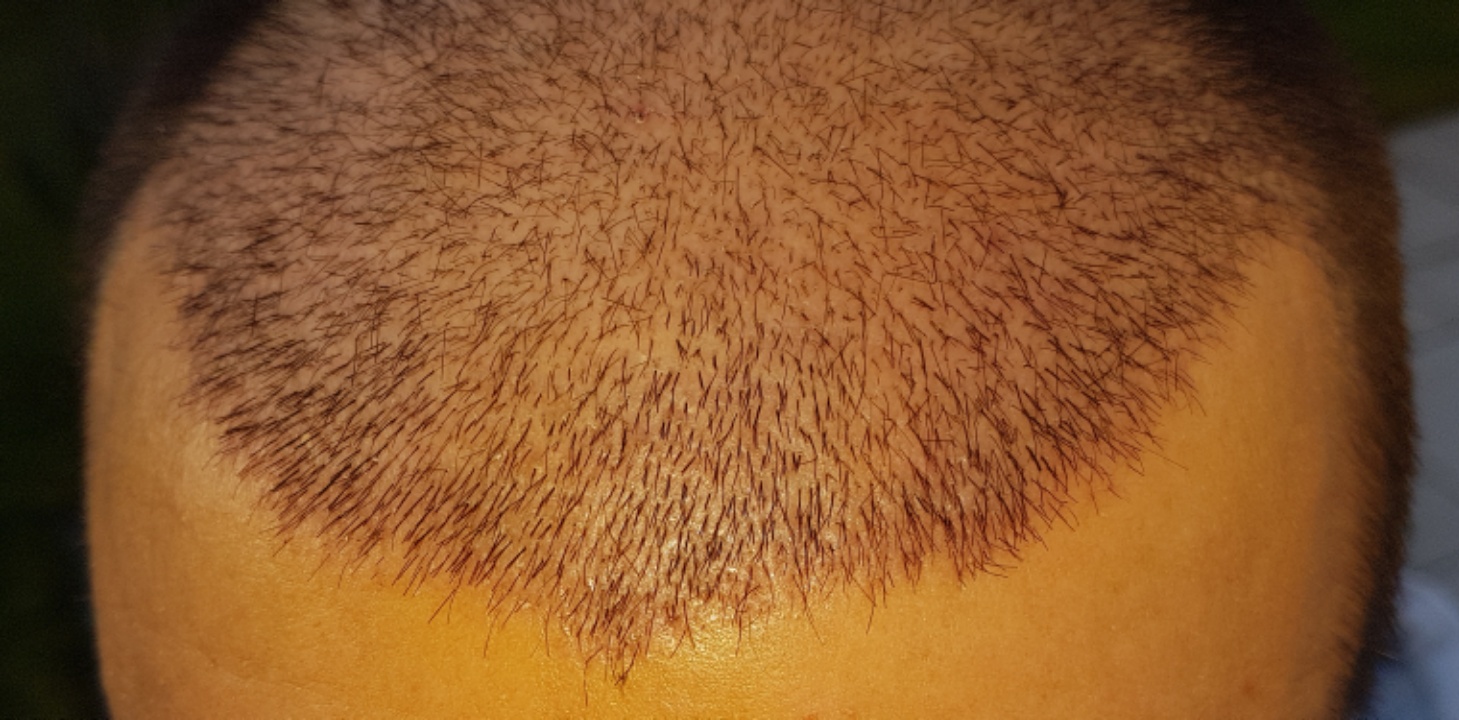 /foren/transplant/index.php?t=getfile&id=45081&private=0