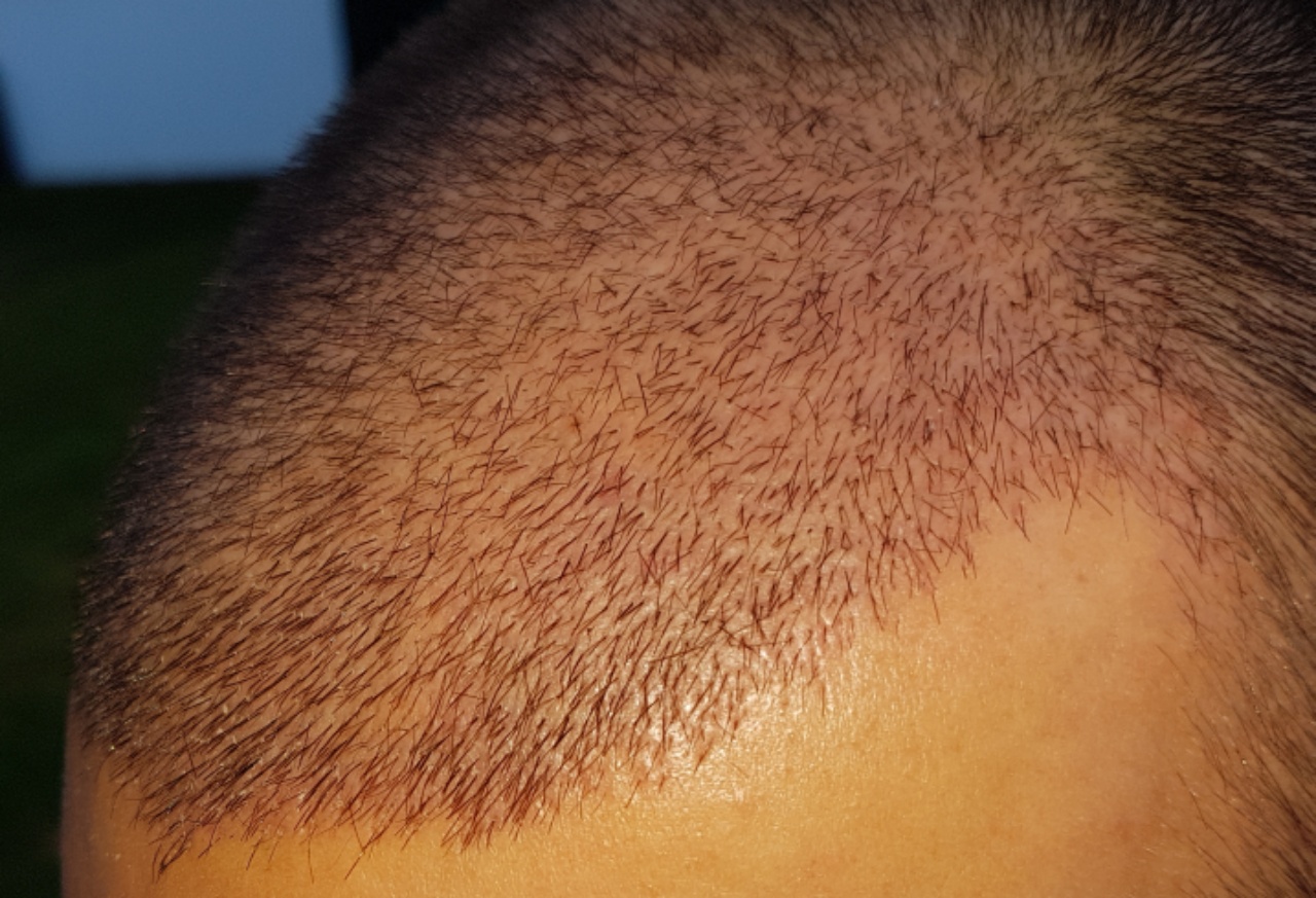 /foren/transplant/index.php?t=getfile&id=45082&private=0