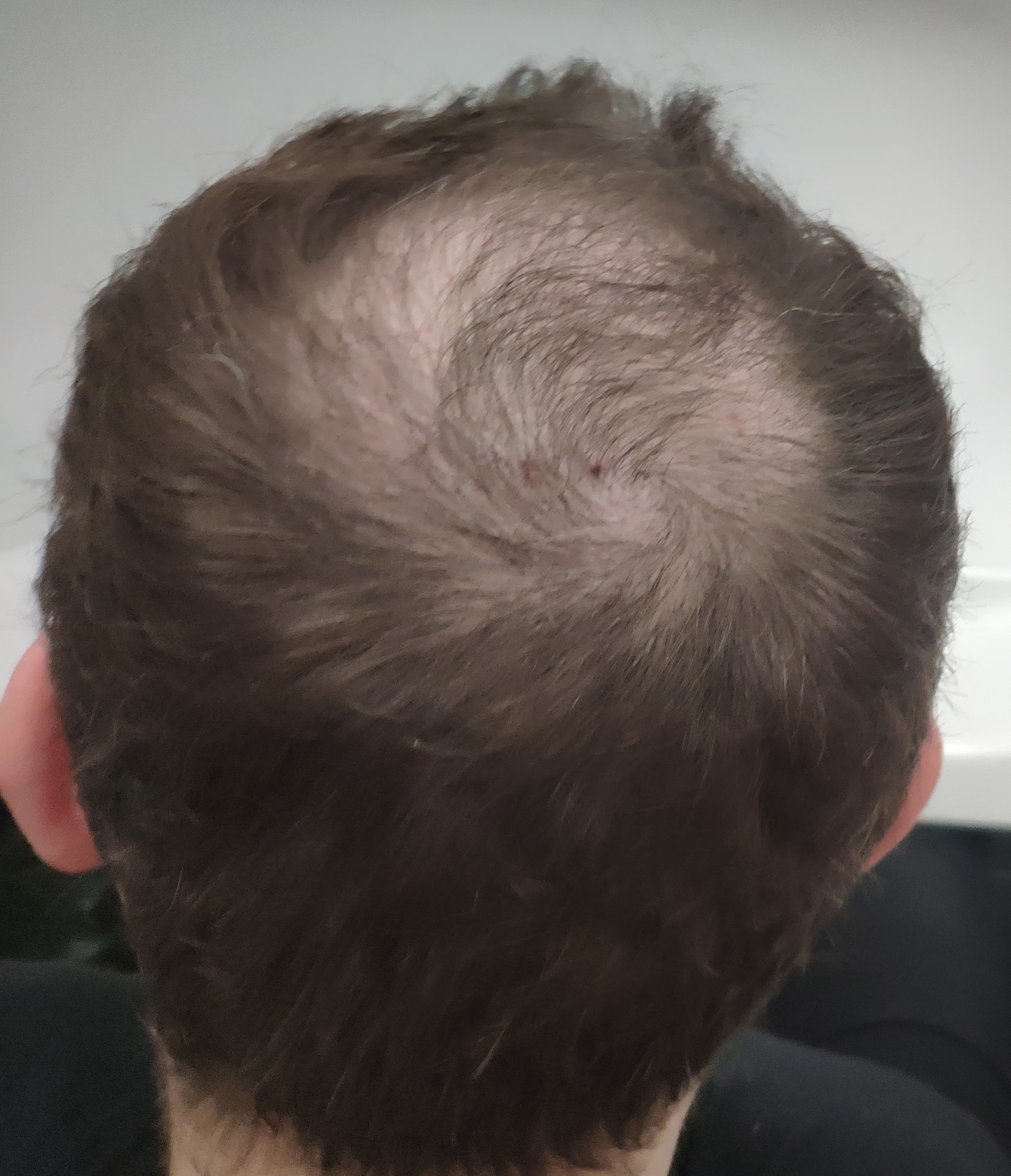 /foren/transplant/index.php?t=getfile&id=45122&private=0