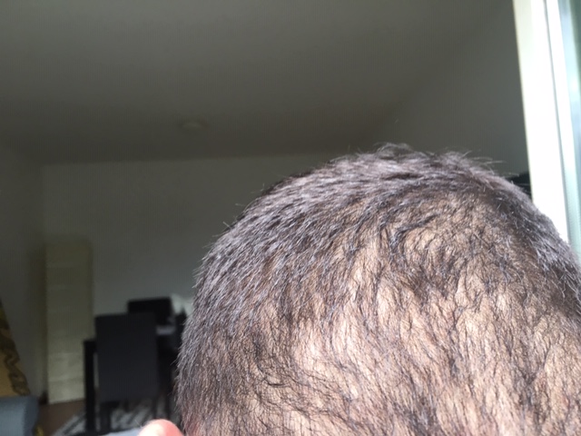 /foren/transplant/index.php?t=getfile&id=45137&private=0