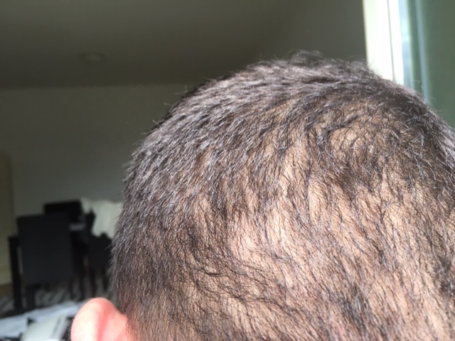 /foren/transplant/index.php?t=getfile&id=45138&private=0