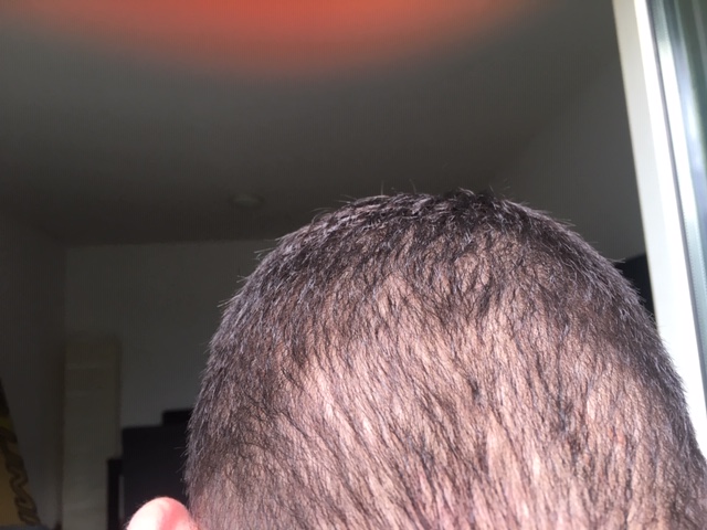 /foren/transplant/index.php?t=getfile&id=45139&private=0