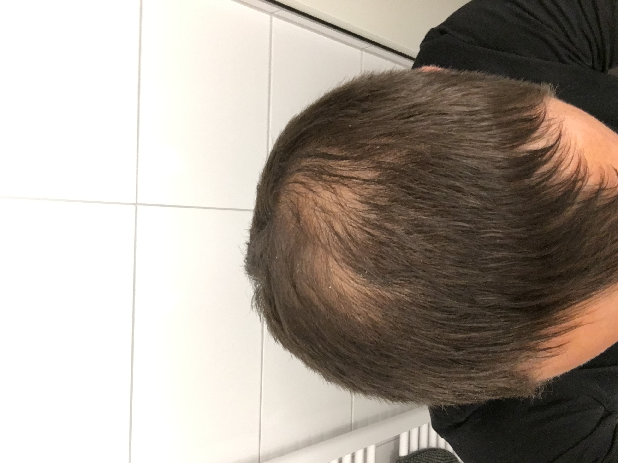 /foren/transplant/index.php?t=getfile&id=45143&private=0