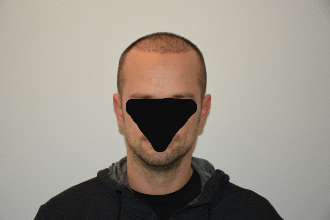 /foren/transplant/index.php?t=getfile&id=45211&private=0