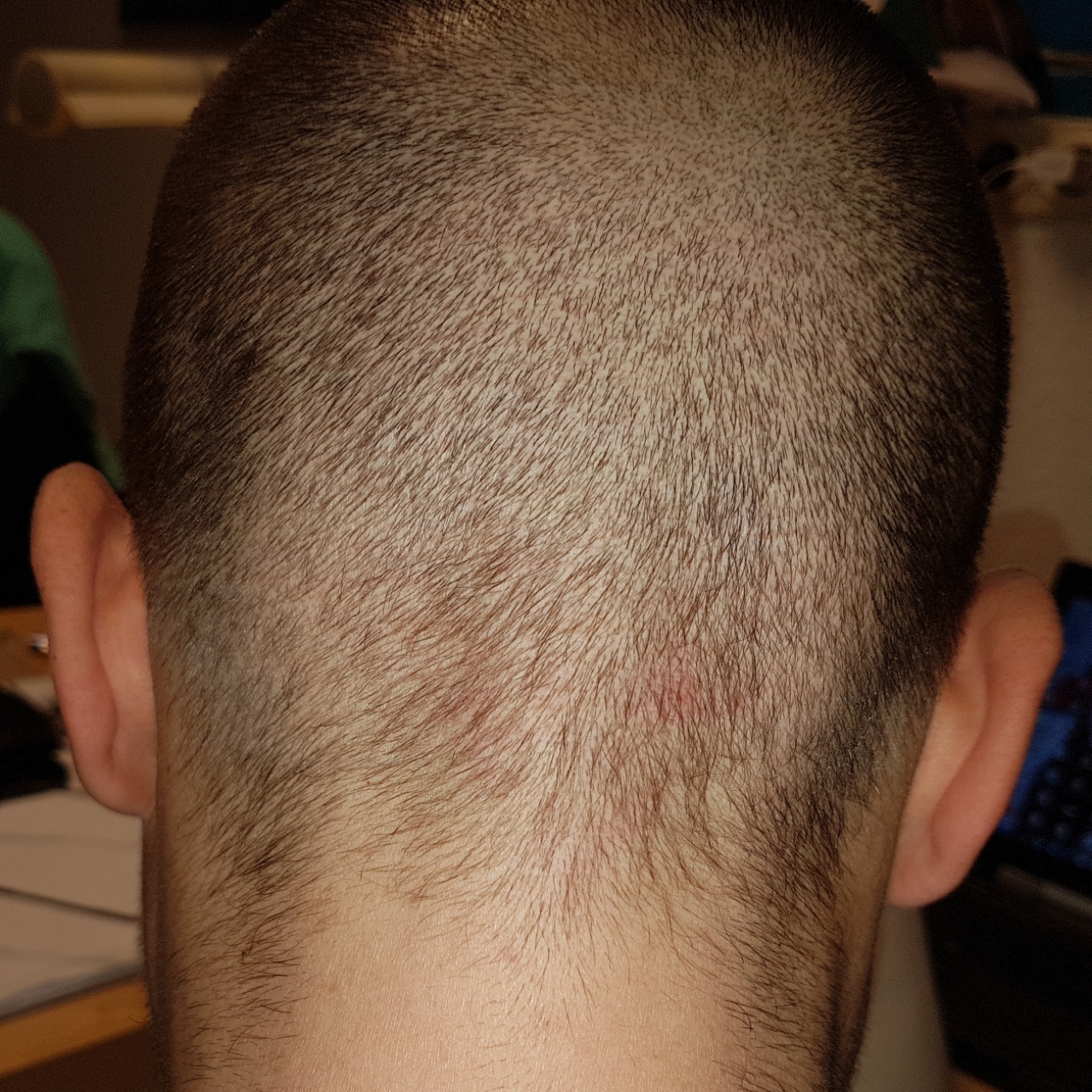 /foren/transplant/index.php?t=getfile&id=45359&private=0