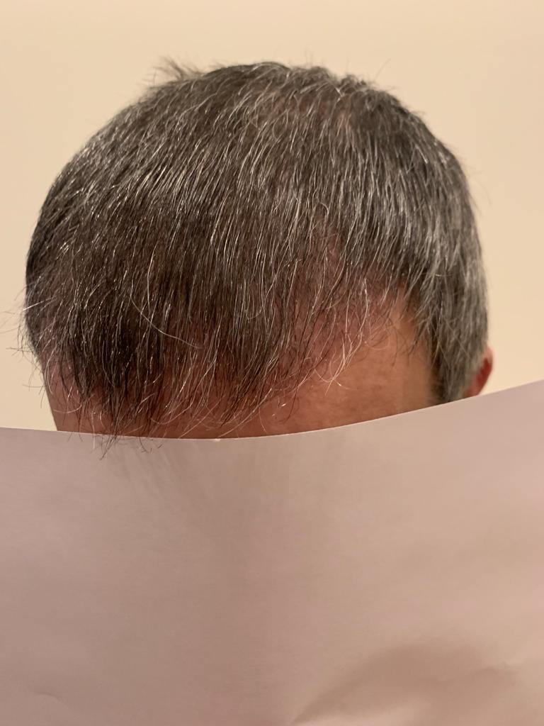 /foren/transplant/index.php?t=getfile&id=45498&private=0