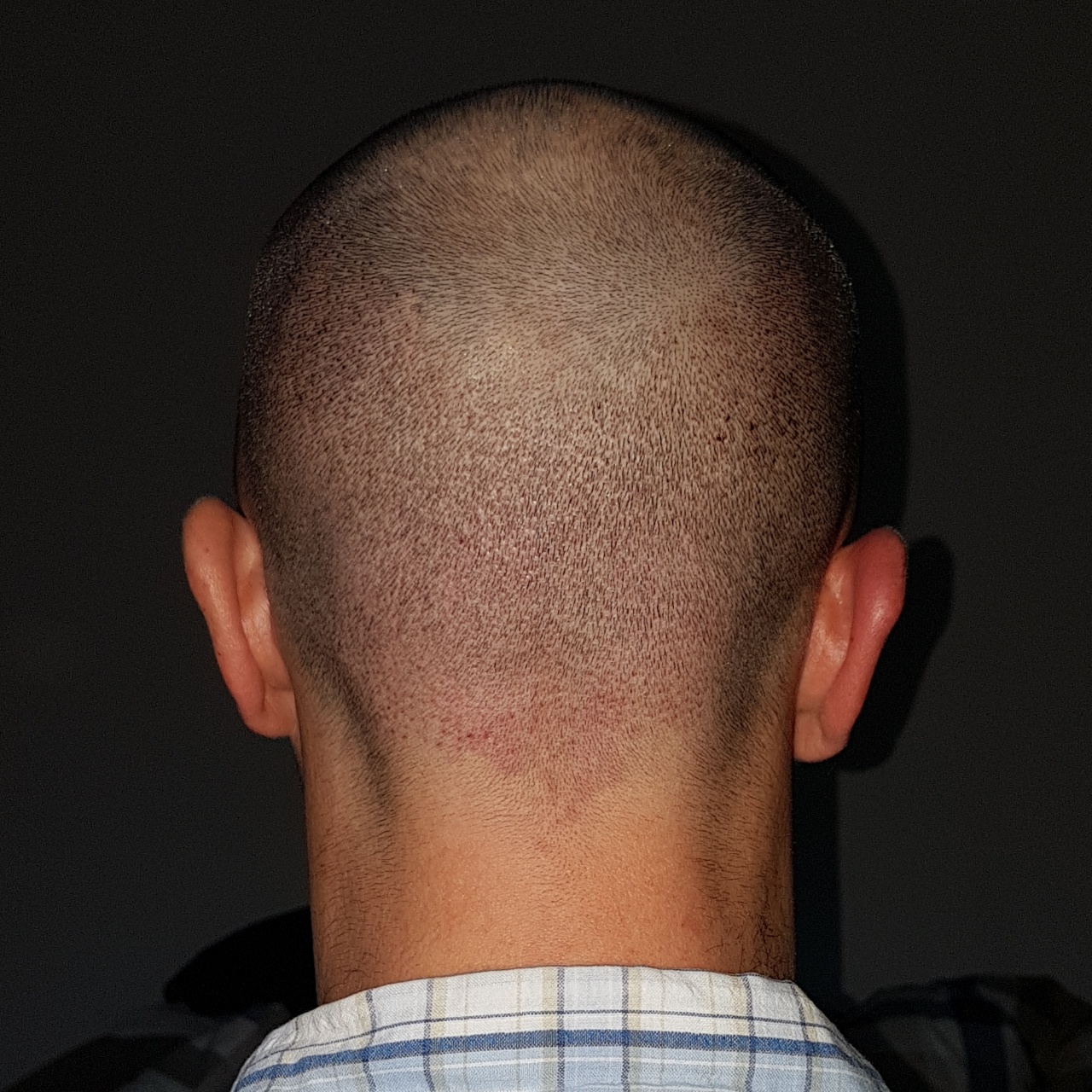 /foren/transplant/index.php?t=getfile&id=45598&private=0