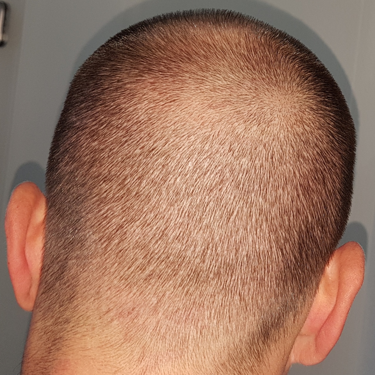 /foren/transplant/index.php?t=getfile&id=45602&private=0