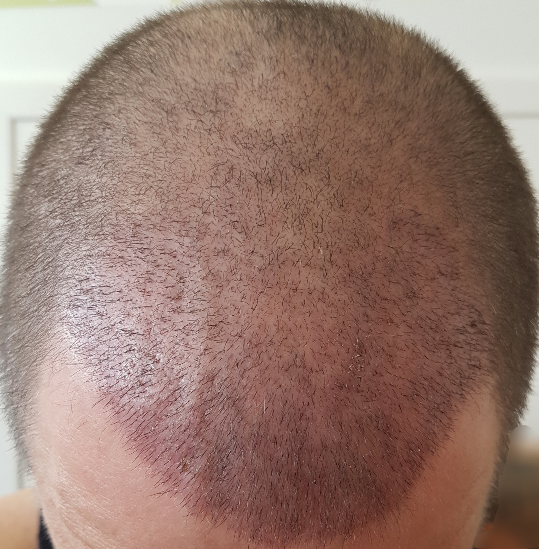 /foren/transplant/index.php?t=getfile&id=45866&private=0