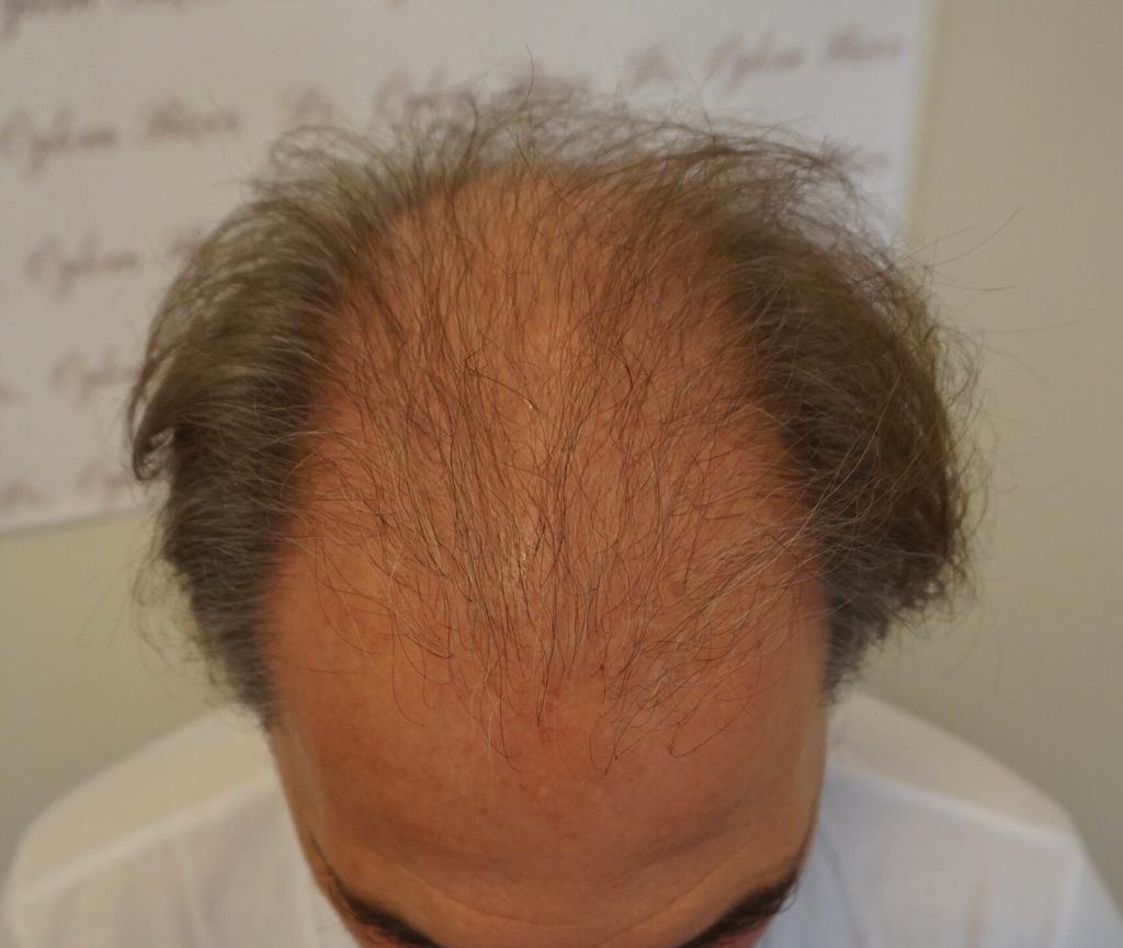 /foren/transplant/index.php?t=getfile&id=45891&private=0