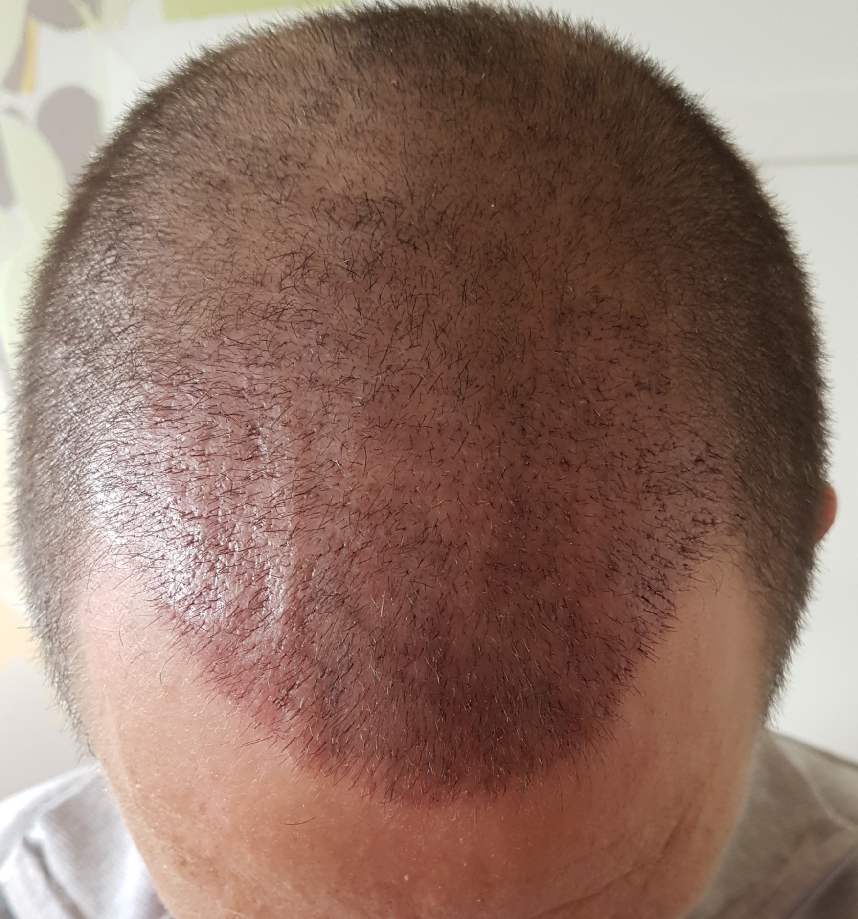 /foren/transplant/index.php?t=getfile&id=45918&private=0