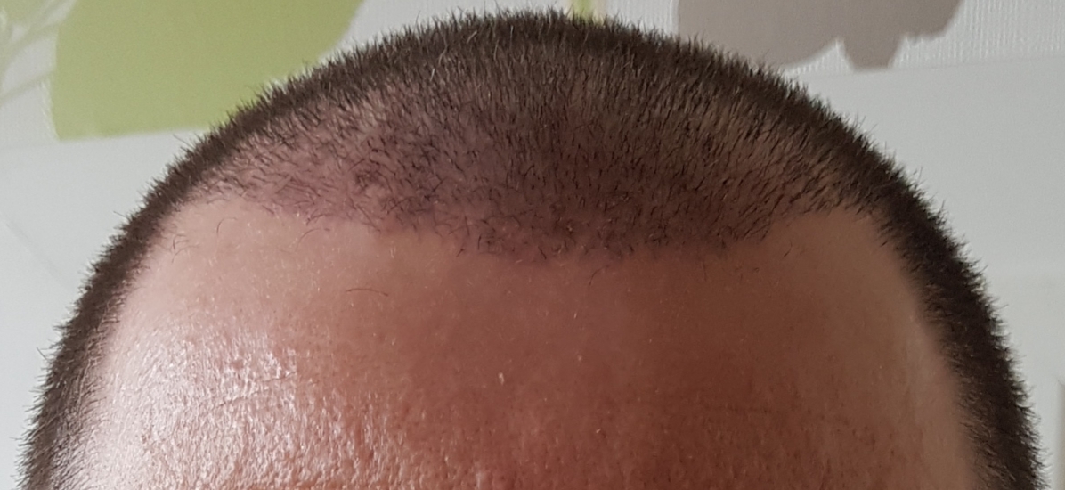 /foren/transplant/index.php?t=getfile&id=45919&private=0