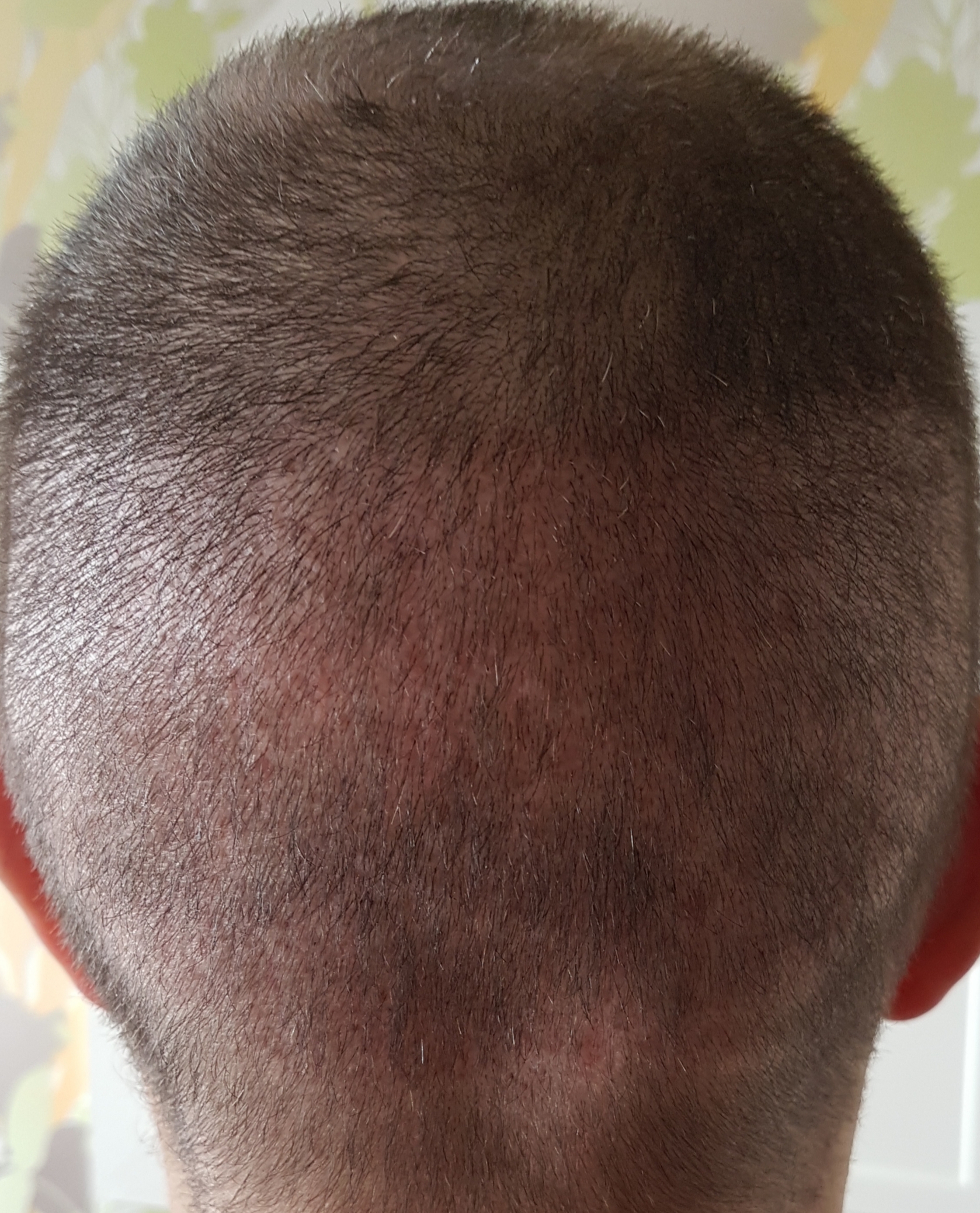 /foren/transplant/index.php?t=getfile&id=45920&private=0