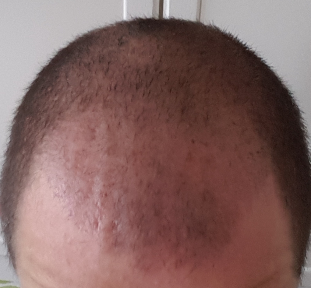 /foren/transplant/index.php?t=getfile&id=46094&private=0