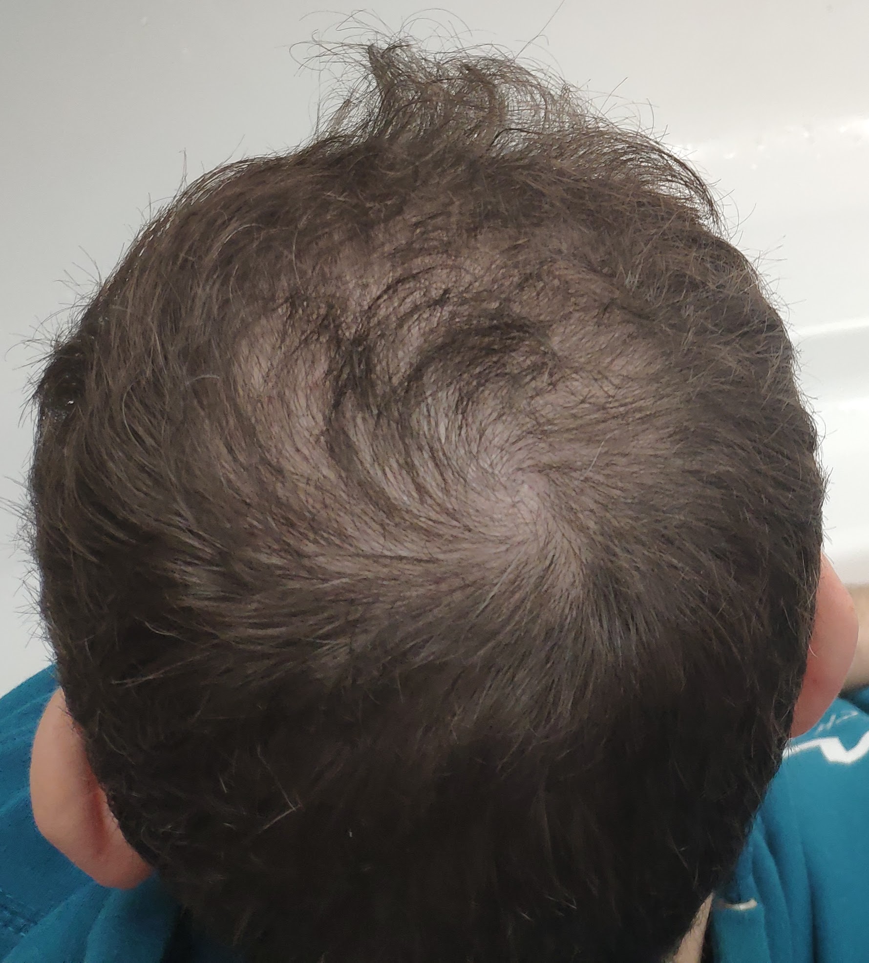 /foren/transplant/index.php?t=getfile&id=46303&private=0