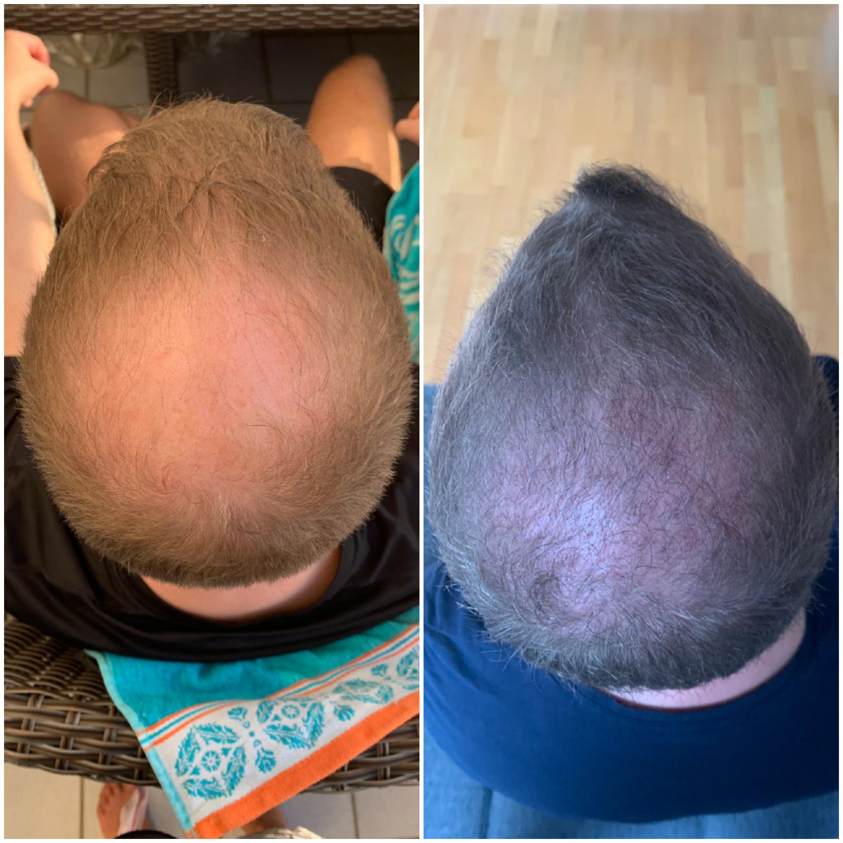 /foren/transplant/index.php?t=getfile&id=46308&private=0