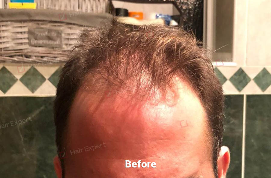 /foren/transplant/index.php?t=getfile&id=46326&private=0