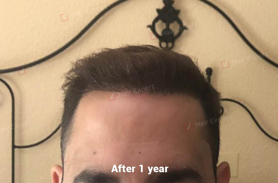 /foren/transplant/index.php?t=getfile&id=46327&private=0