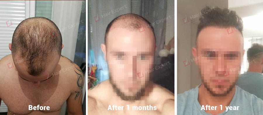 /foren/transplant/index.php?t=getfile&id=46352&private=0