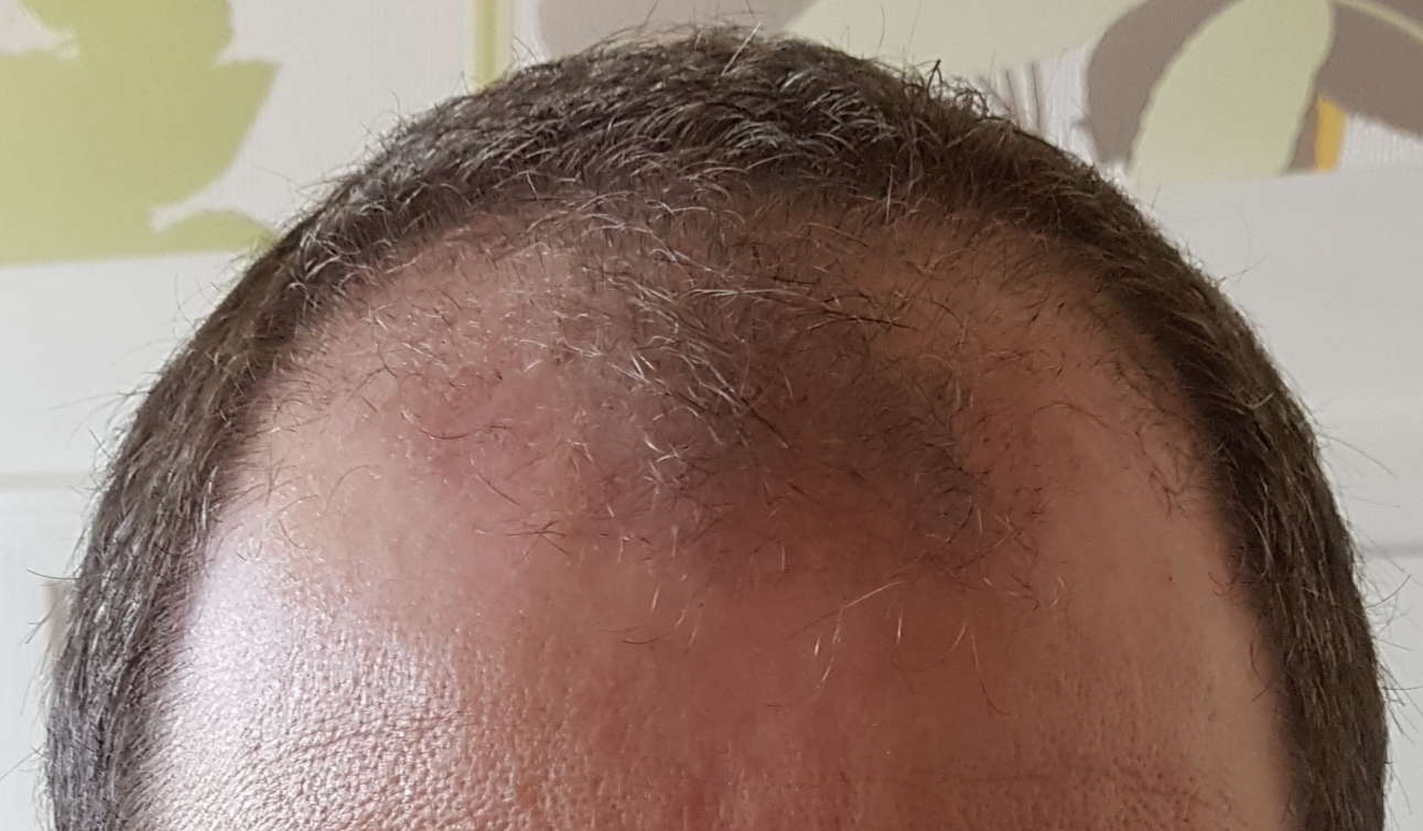 /foren/transplant/index.php?t=getfile&id=46477&private=0