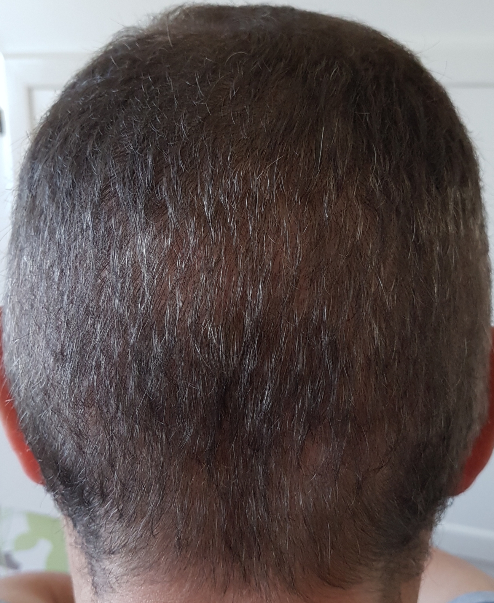 /foren/transplant/index.php?t=getfile&id=46479&private=0