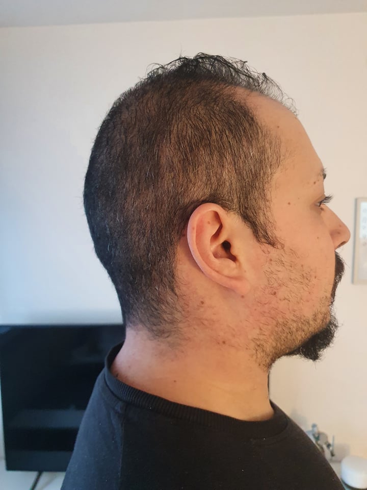 /foren/transplant/index.php?t=getfile&id=49709&private=0