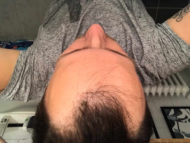 /foren/transplant/index.php?t=getfile&id=41296&private=0