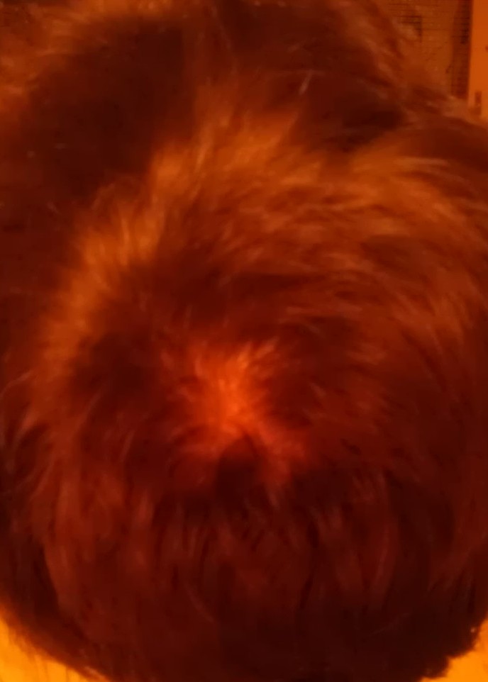 index.php/fa/10011/0/