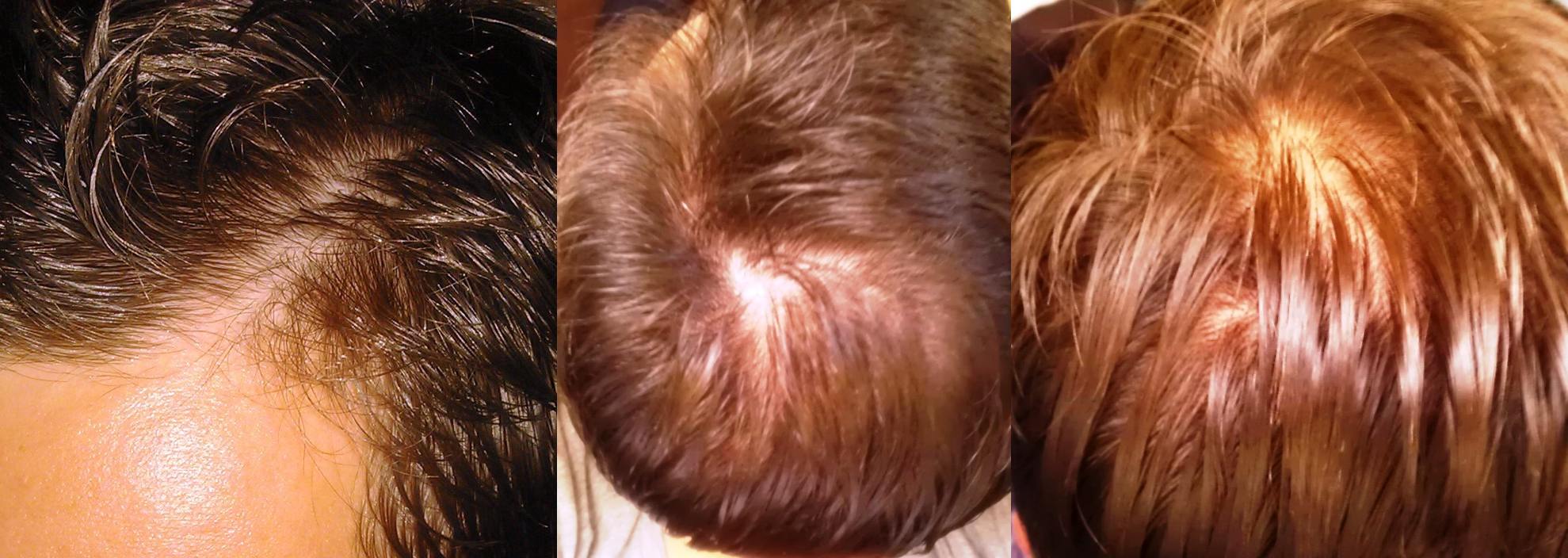 index.php/fa/10215/0/