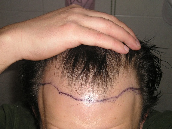 index.php/fa/11020/0/