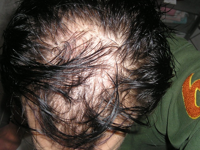 index.php/fa/11021/0/