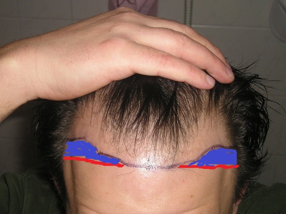 index.php/fa/11025/0/