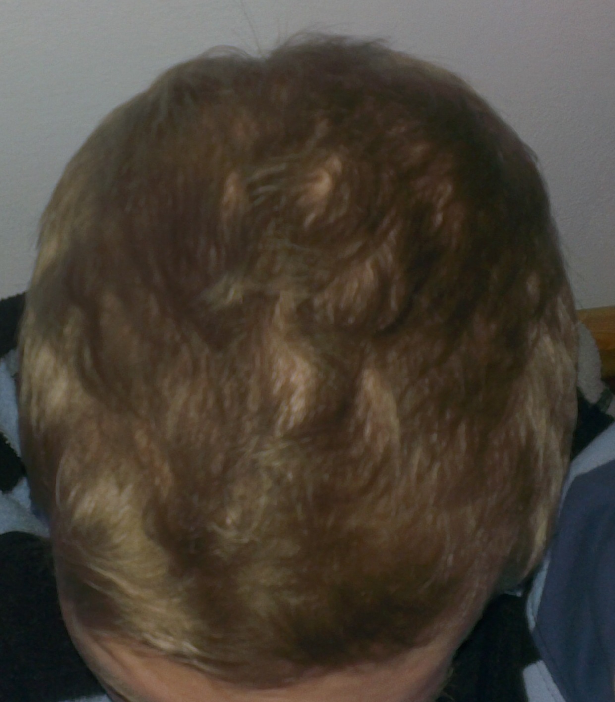 index.php/fa/11544/0/