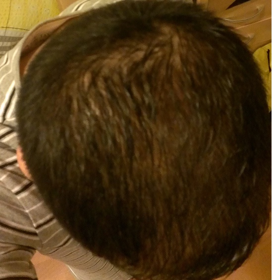 index.php/fa/11547/0/