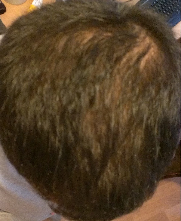 index.php/fa/11588/0/