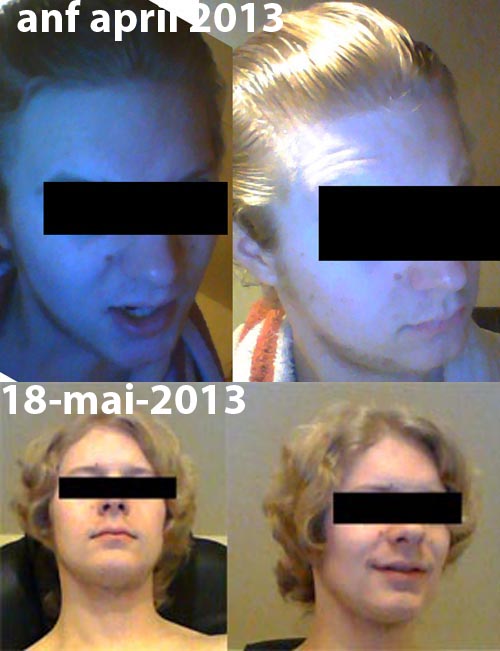 index.php/fa/11869/0/