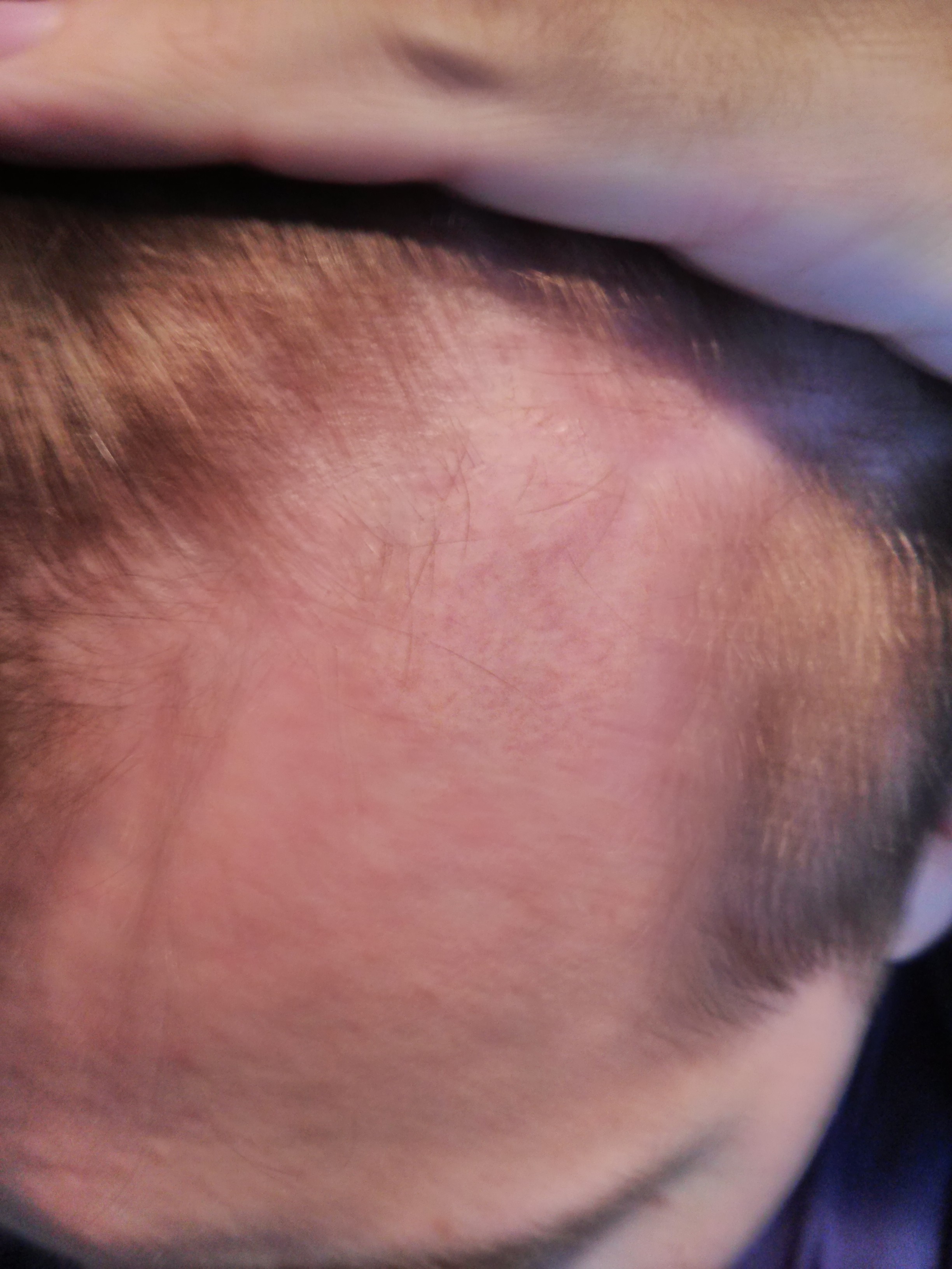 index.php/fa/12054/0/