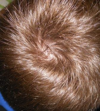 index.php/fa/12103/0/