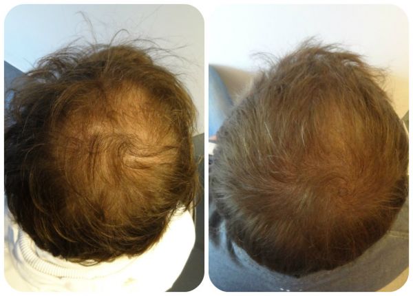 index.php/fa/12179/0/