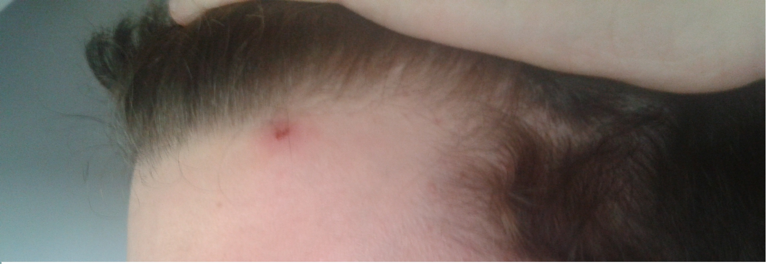 index.php/fa/12263/0/