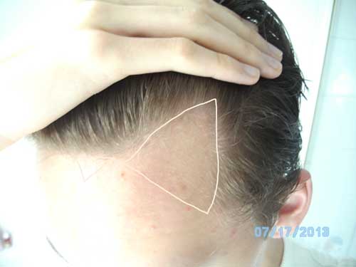 index.php/fa/12282/0/