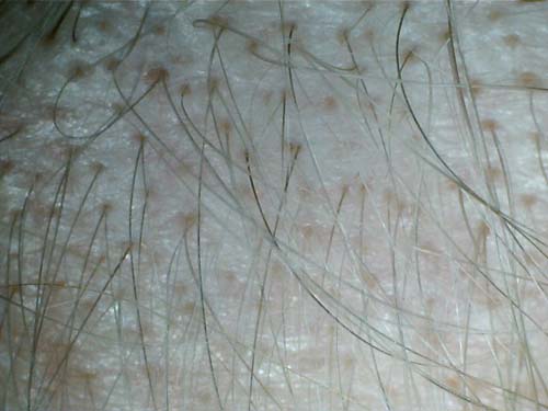 index.php/fa/12319/0/