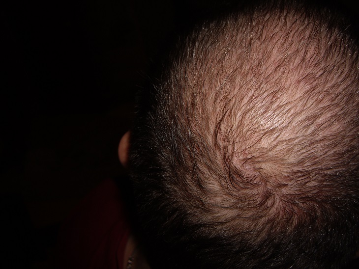 index.php/fa/12939/0/