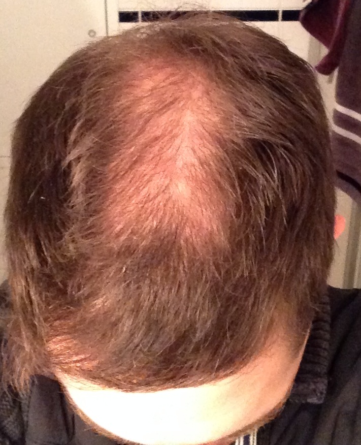 index.php/fa/13061/0/